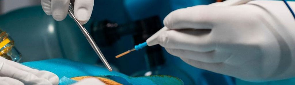 ابزار الکتروسرجری جراحی اندوسکوپی