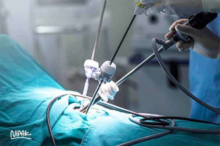 تفاوت لاپاراسکوپي با عمل باز تخمدان و رحم