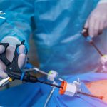 جراحي لاپاراسکوپي رحم و تخمدان