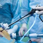 تجهیزات لاپاراسکوپی